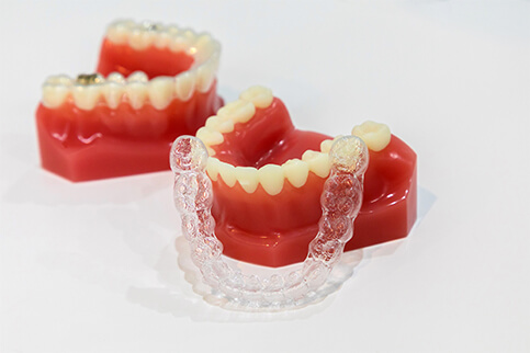 インビザラインの特徴